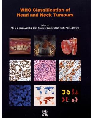 Who Classification of Head and Neck Tumours Who Classification of Head and Neck Tumours