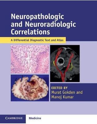 Neuropathologic and Neuroradiologic Correlations: A Differential Diagnostic Text and Atlas Neuropathologic and Neuroradiologic Correlations: A Differential Diagnostic Text and Atlas
