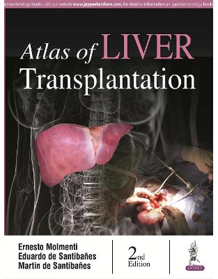 Atlas of Liver Transplantation Atlas of Liver Transplantation