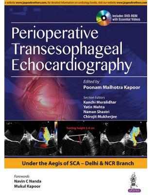 Perioperative Transeasophageal Echocardiography Perioperative Transeasophageal Echocardiography