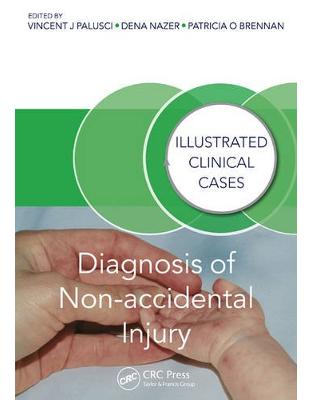 Diagnosis of Non-accidental Injury Diagnosis of Non-accidental Injury