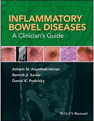 Inflammatory Bowel Diseases: A Clinician's Guide Inflammatory Bowel Diseases: A Clinician's Guide