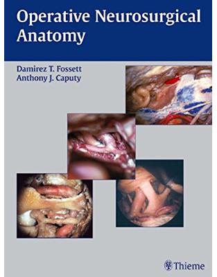 Operative Neurosurgical Anatomy Operative Neurosurgical Anatomy