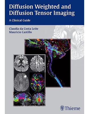 Diffusion Weighted and Diffusion Tensor Imaging: A Clinical Guide Diffusion Weighted and Diffusion Tensor Imaging: A Clinical Guide