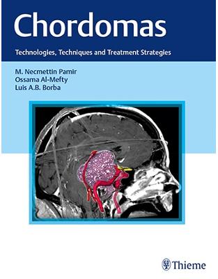 Chordomas: Technologies, Techniques, and Treatment Strategies Chordomas: Technologies, Techniques, and Treatment Strategies