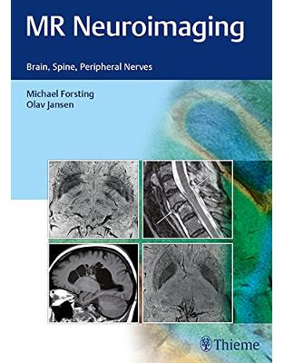 MR Neuroimaging: Brain, Spine, and Peripheral Nerves MR Neuroimaging: Brain, Spine, and Peripheral Nerves
