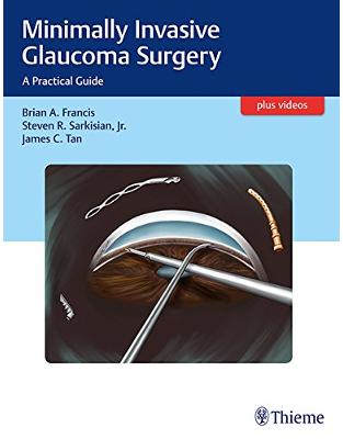 Minimally Invasive Glaucoma Surgery: A Practical Guide Minimally Invasive Glaucoma Surgery: A Practical Guide