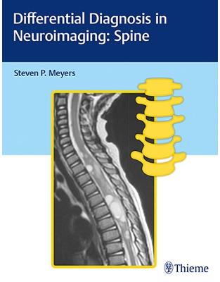 Differential Diagnosis in Neuroimaging Differential Diagnosis in Neuroimaging