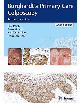 Burghardt's Primary Care Colposcopy Burghardt's Primary Care Colposcopy