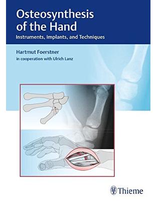 Osteosynthesis of the Hand Osteosynthesis of the Hand