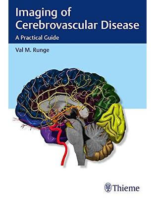 Imaging of Cerebrovascular Disease Imaging of Cerebrovascular Disease