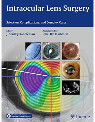 Intraocular Lens Surgery Intraocular Lens Surgery
