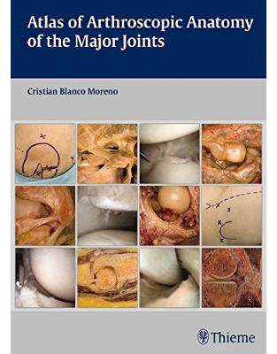 Atlas of Arthroscopic Anatomy of Major Joints Atlas of Arthroscopic Anatomy of Major Joints