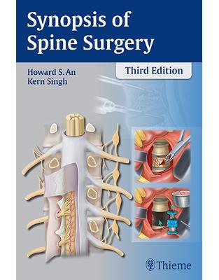 Synopsis of Spine Surgery Synopsis of Spine Surgery