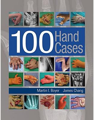 100 Hand Cases 100 Hand Cases