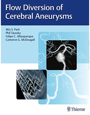 Flow Diversion of Cerebral Aneurysms Flow Diversion of Cerebral Aneurysms