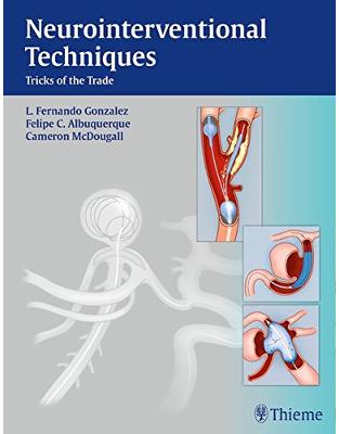 Neurointerventional Techniques Neurointerventional Techniques