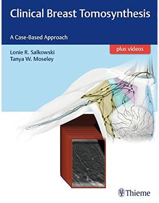 Clinical Breast Tomosynthesis Clinical Breast Tomosynthesis