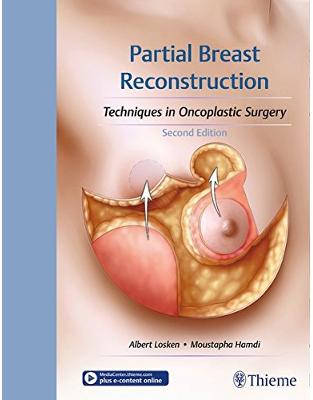 Partial Breast Reconstruction Partial Breast Reconstruction