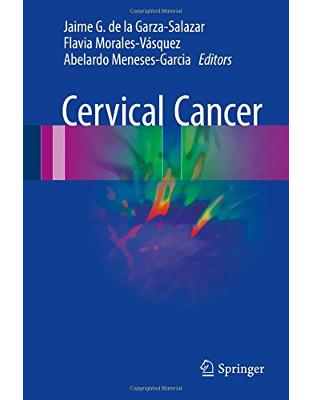 Cervical Cancer Cervical Cancer