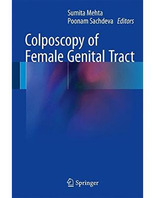 Colposcopy of Female Genital Tract Colposcopy of Female Genital Tract