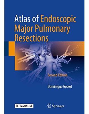 Atlas of Endoscopic Major Pulmonary Resections Atlas of Endoscopic Major Pulmonary Resections