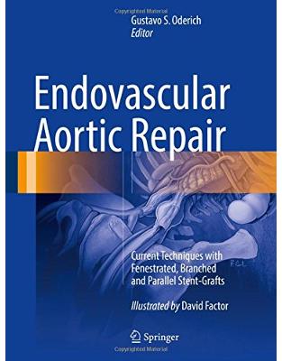 Endovascular Aortic Repair: Current Techniques with Fenestrated, Branched and Parallel Stent-Grafts Endovascular Aortic Repair: Current Techniques with Fenestrated, Branched and Parallel Stent-Grafts