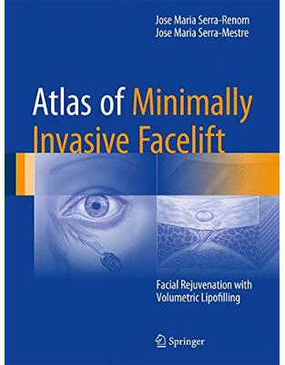 Atlas of Minimally Invasive Facelift: Facial Rejuvenation with Volumetric Lipofilling Atlas of Minimally Invasive Facelift: Facial Rejuvenation with Volumetric Lipofilling