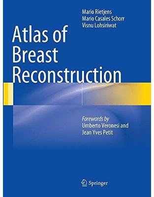 Atlas of Breast Reconstruction Atlas of Breast Reconstruction