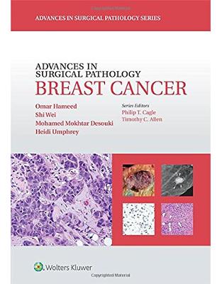 Advances in Surgical Pathology: Breast Cancer Advances in Surgical Pathology: Breast Cancer