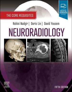 Coperta cărții "Neuroradiology: The Core Requisites" de autor necunoscut