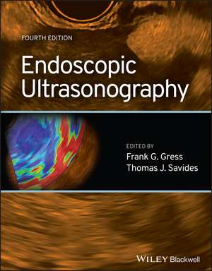 Coperta cărții "Endoscopic Ultrasonography 4e" de autor necunoscut