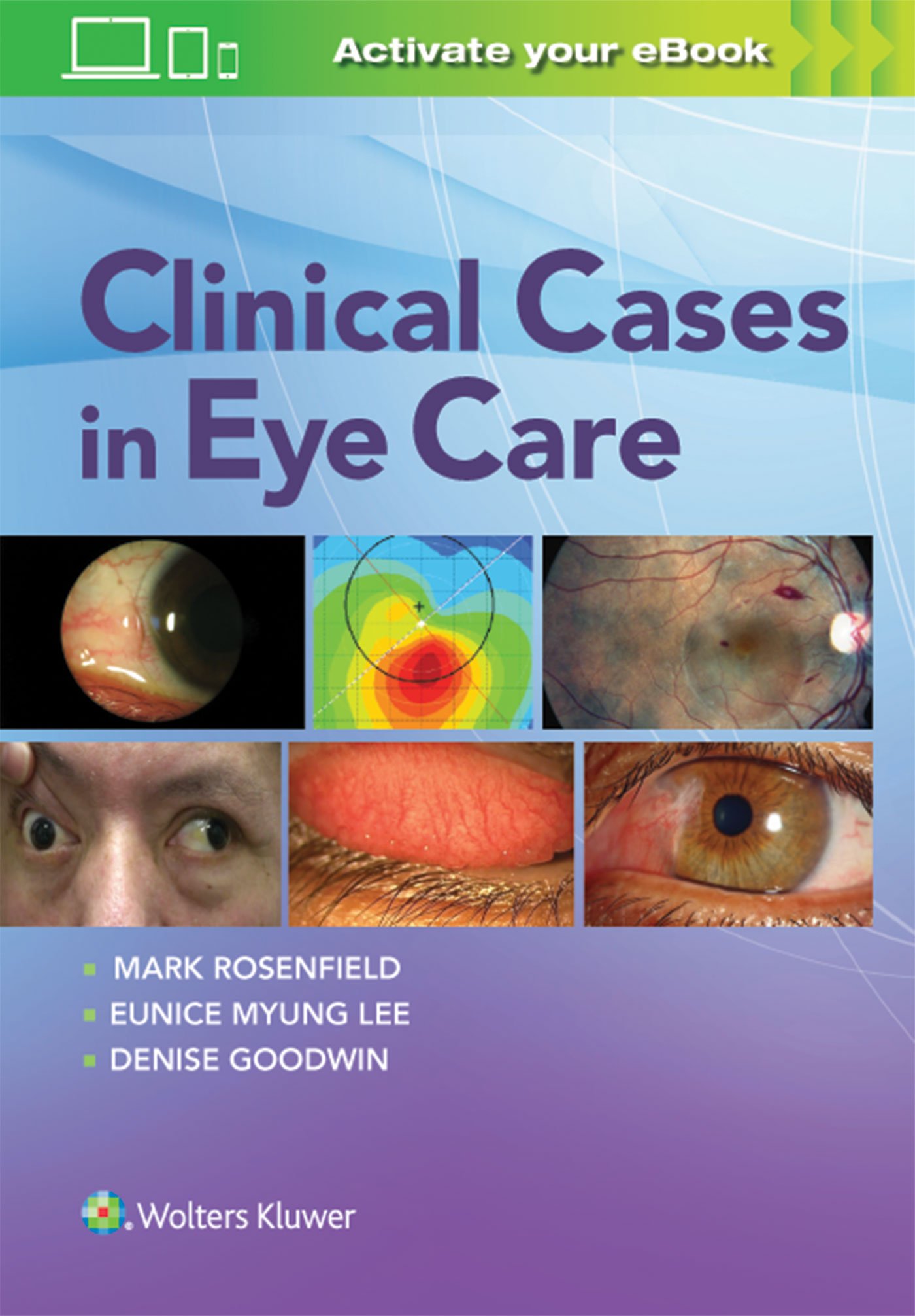 Coperta cărții "Clinical Cases in Eye Care" de autor necunoscut