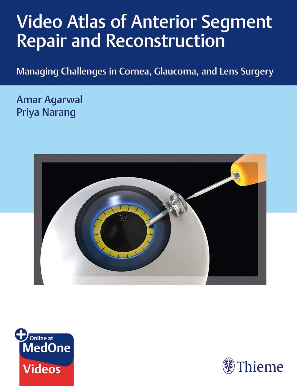 Coperta cărții "Video Atlas of Anterior Segment Repair and Reconstruction" de autor necunoscut
