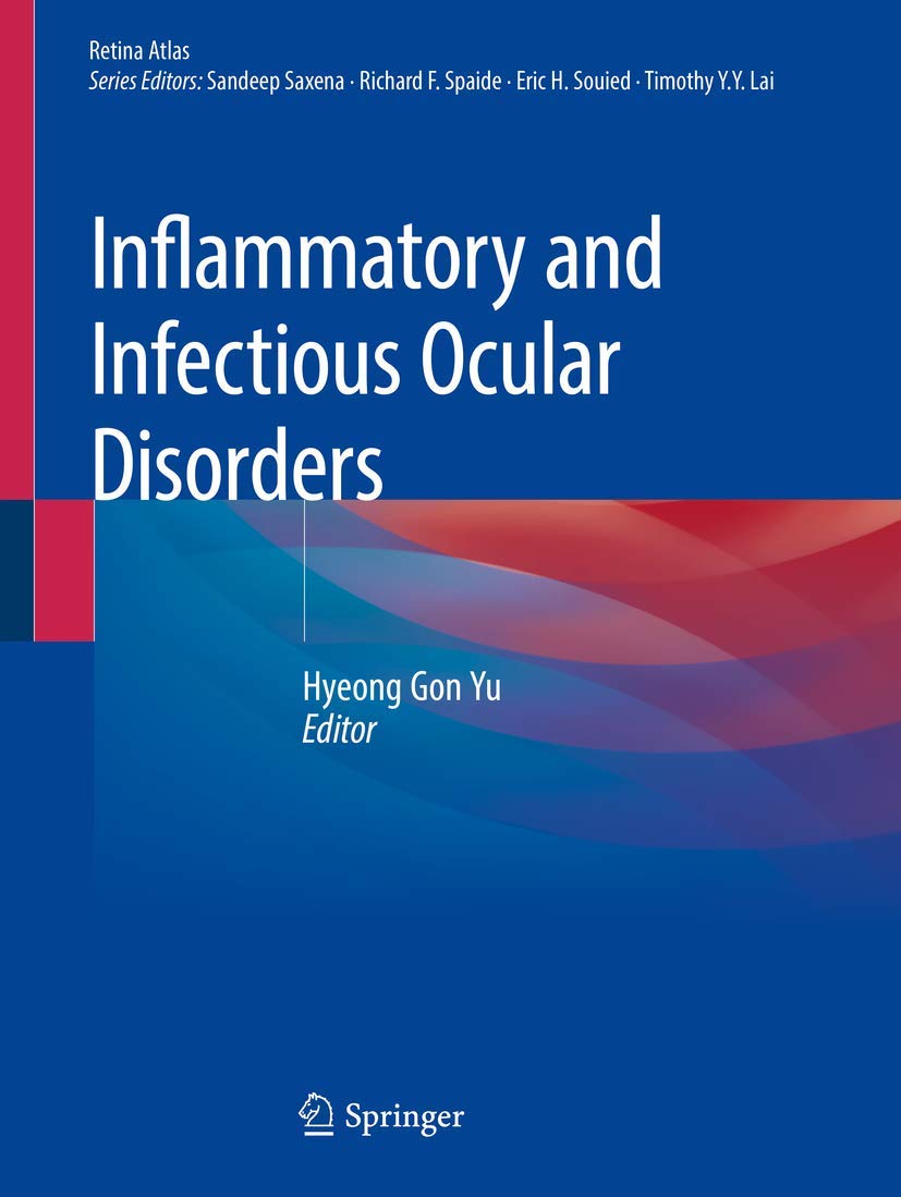 Coperta cărții "Inflammatory and Infectious Ocular Disorders (Retina Atlas)" de autor necunoscut