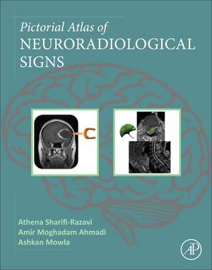 Coperta cărții "Pictorial Atlas of Neuroradiological Signs" de autor necunoscut