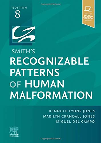 Coperta cărții "Smith&#039;s Recognizable Patterns of Human Malformation: Expert Consult - Online and Print" de autor necunoscut