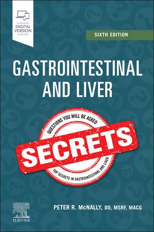 Coperta cărții "Gastrointestinal and Liver Secrets" de autor necunoscut