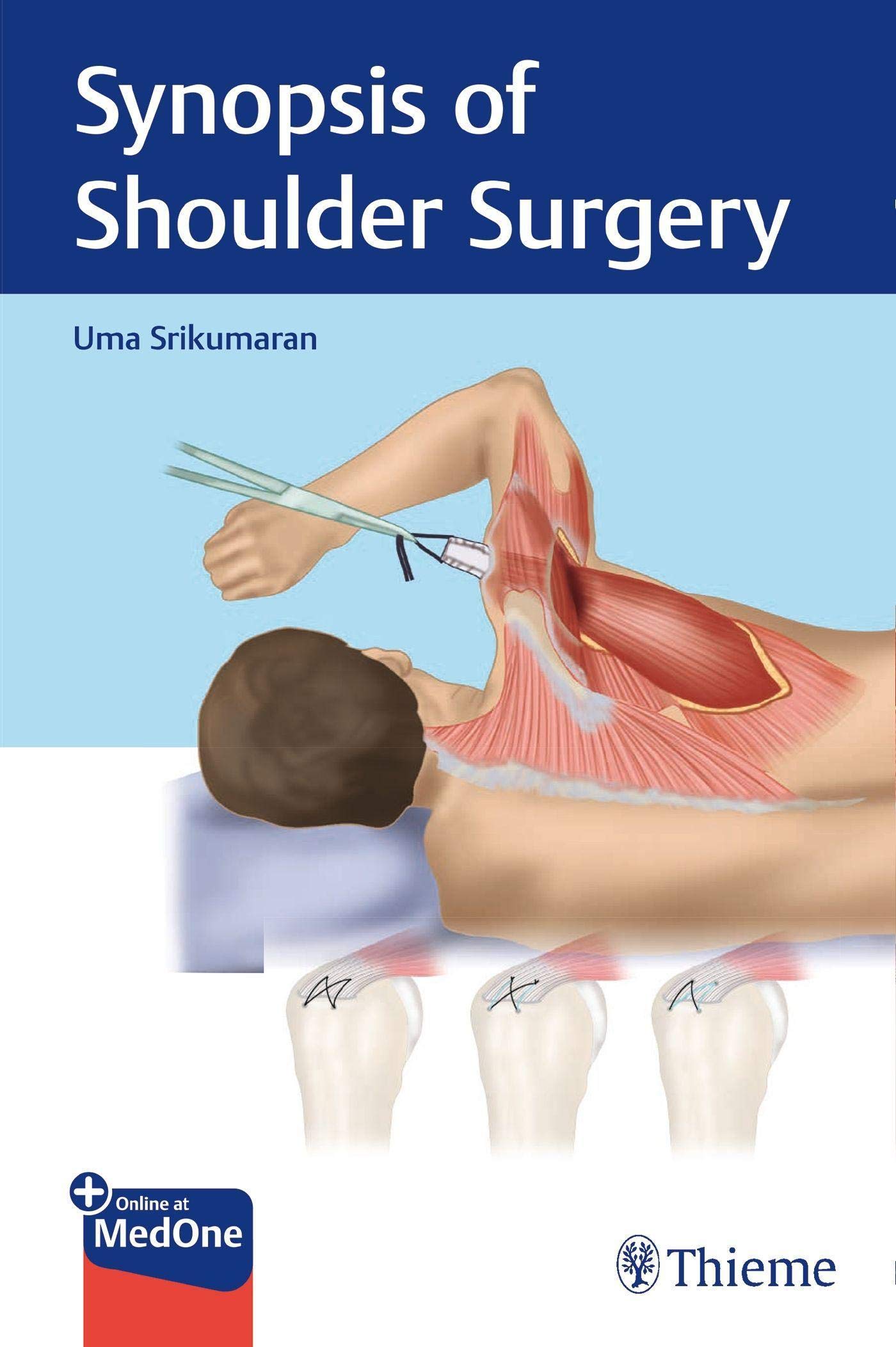 Coperta cărții "Synopsis of Shoulder Surgery" de autor necunoscut