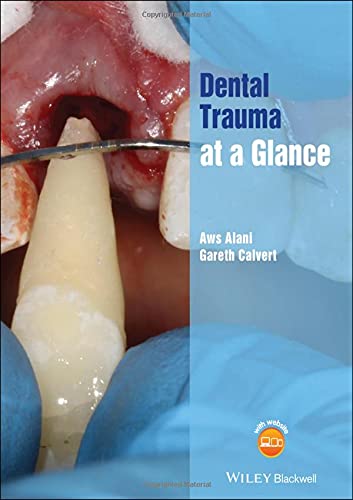 Coperta cărții "Dental Trauma at a Glance" de autor necunoscut