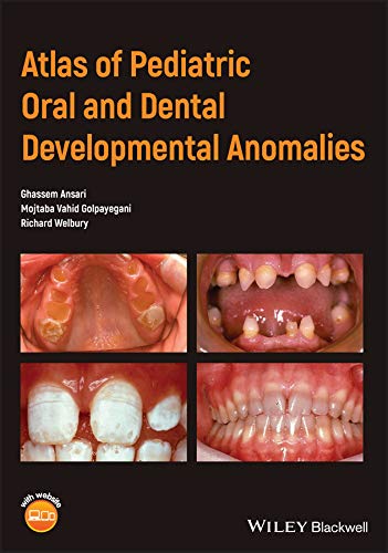 Coperta cărții "Atlas of Pediatric Oral and Dental Developmental Anomalies" de autor necunoscut