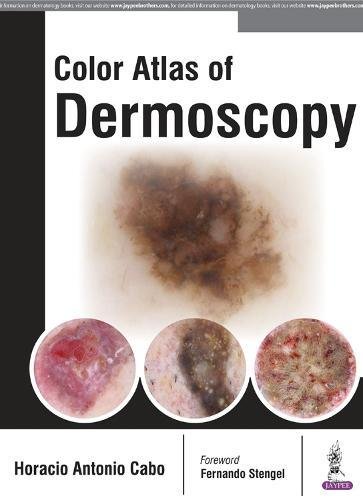 Coperta cărții "Color Atlas of Dermoscopy" de autor necunoscut