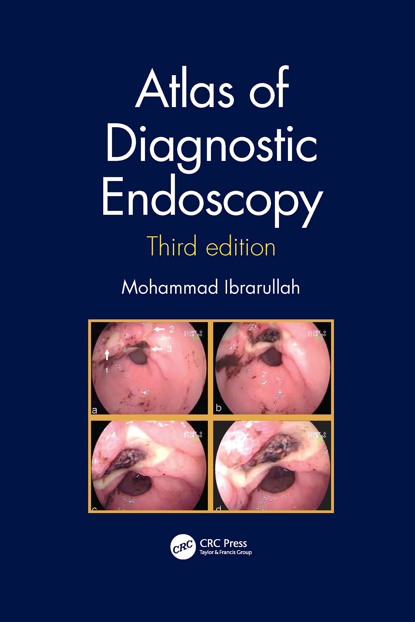 Coperta cărții "Atlas of Diagnostic Endoscopy, 3E" de autor necunoscut