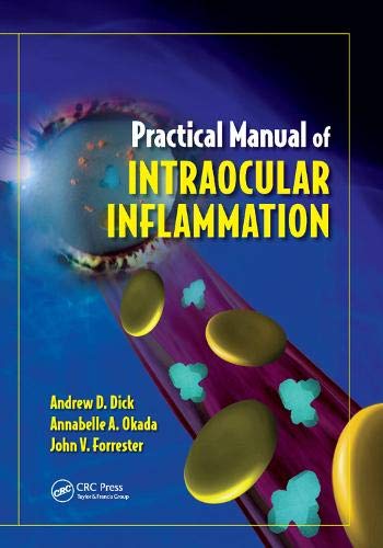 Coperta cărții "Practical Manual of Intraocular Inflammation" de autor necunoscut