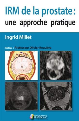 Coperta cărții "IRM DE LA PROSTATE" de autor necunoscut