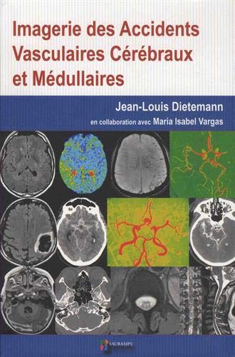 Coperta cărții "IMAGERIE DES ACCIDENTS VASCULAIRES CEREBRAUX ET MEDULLAIRES" de autor necunoscut