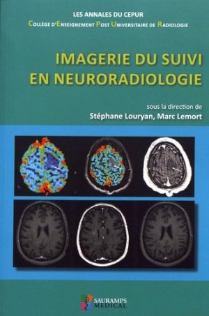 Coperta cărții "IMAGERIE DU SUIVI EN NEURORADIOLOGIE" de autor necunoscut
