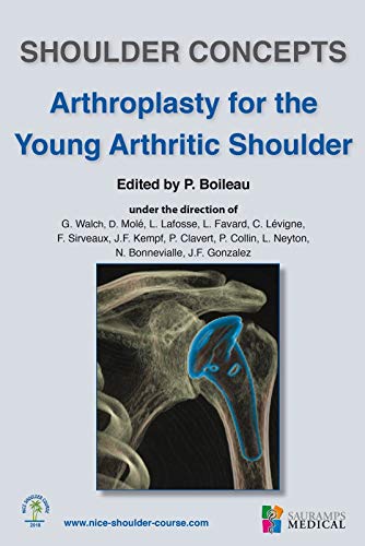 Coperta cărții "ARTHROPLASTY FOR THE YOUNG ARTHRITIC SHOULDER" de autor necunoscut