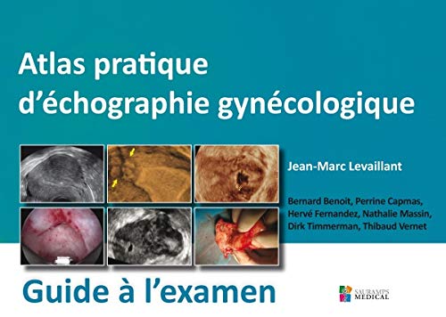 Coperta cărții "ATLAS PRATIQUE D&#039;ECHOGRAPHIE GYNECOLOGIQUE - GUIDE A L&#039;EXAMEN" de autor necunoscut