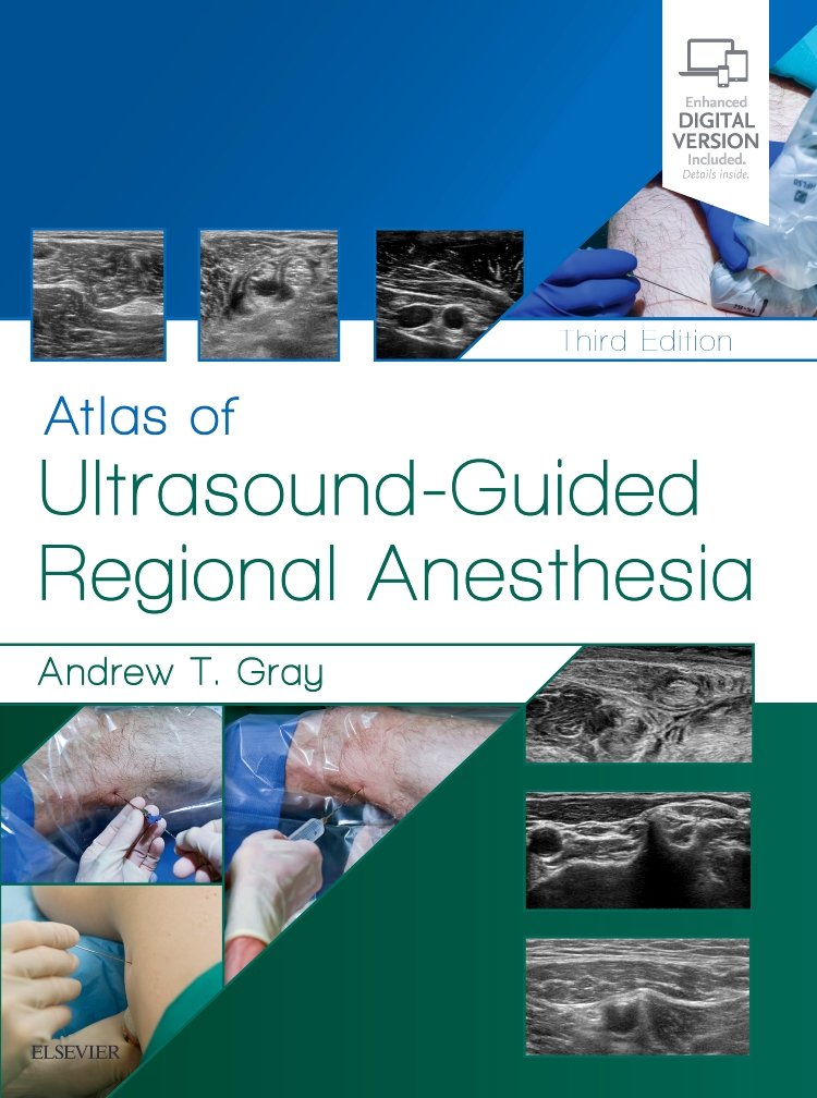 Coperta cărții "Atlas of Ultrasound-Guided Regional Anesthesia, 3e: Expert Consult - Online and Print" de autor necunoscut